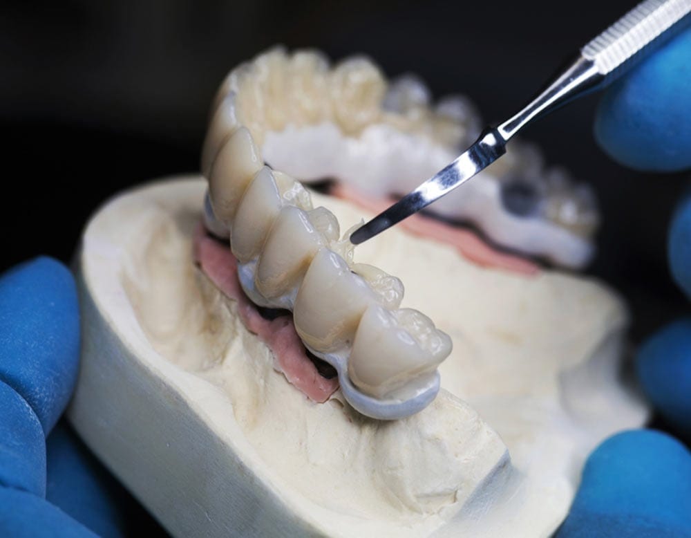 A person wearing blue latex gloves repairs dentures