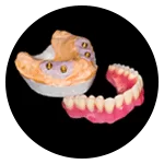 Denture implant at Jasper Denture Clinic