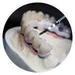 Dentures being repaired at Jasper Denture Clinic